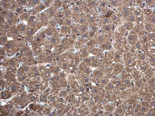 TrxR1 Antibody in Immunohistochemistry (Paraffin) (IHC (P))