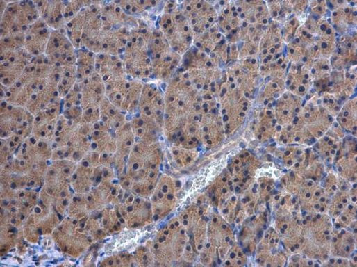 TrxR1 Antibody in Immunohistochemistry (Paraffin) (IHC (P))