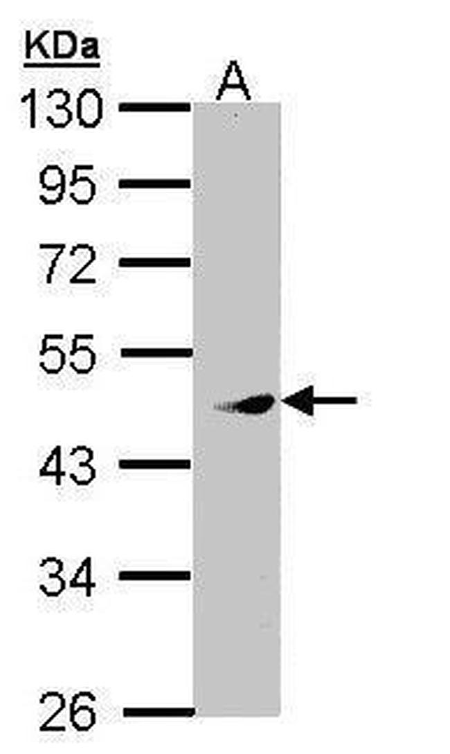 PRAK Antibody in Western Blot (WB)