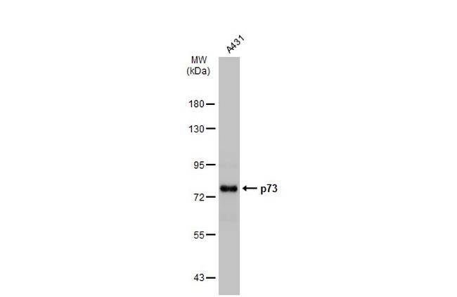 p73 Antibody in Western Blot (WB)