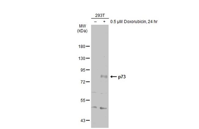 p73 Antibody in Western Blot (WB)