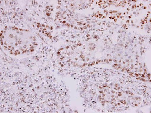 p73 Antibody in Immunohistochemistry (Paraffin) (IHC (P))