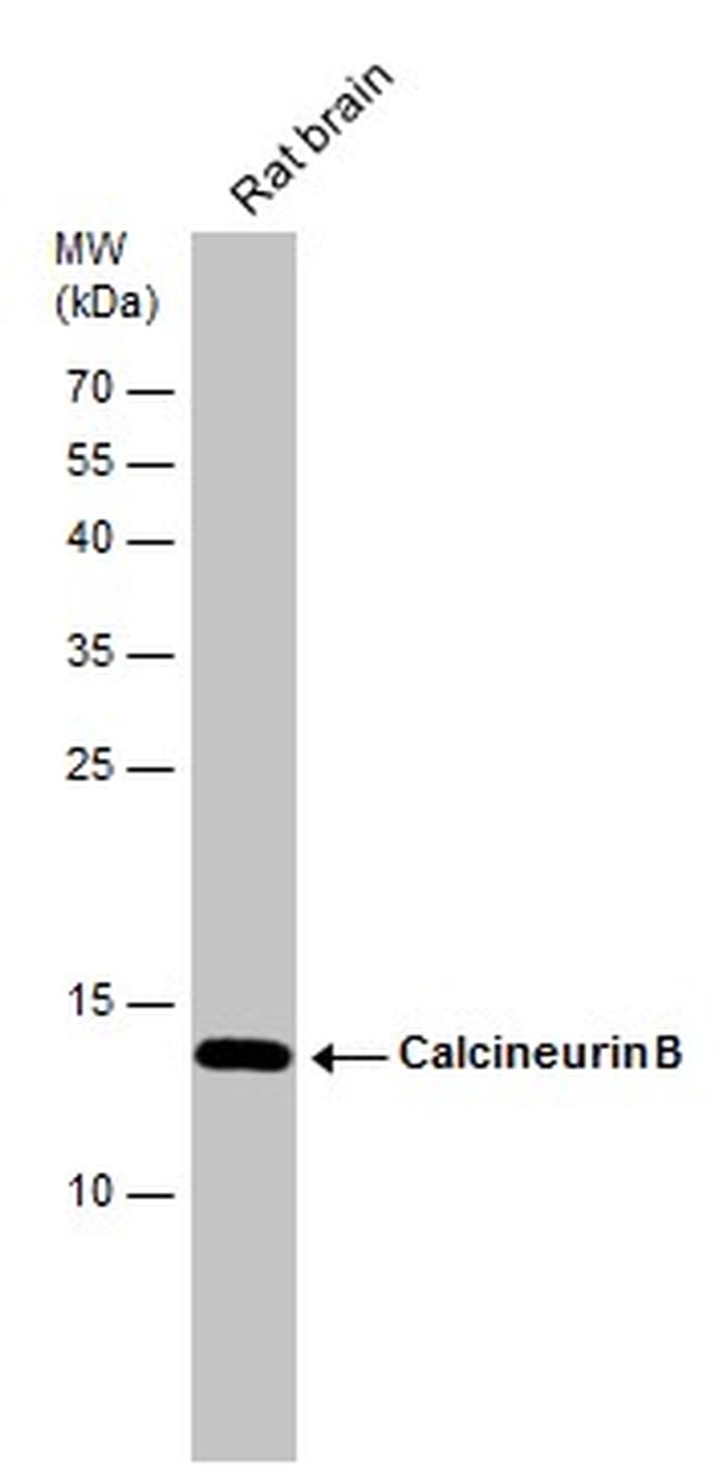 Calcineurin B Antibody in Western Blot (WB)