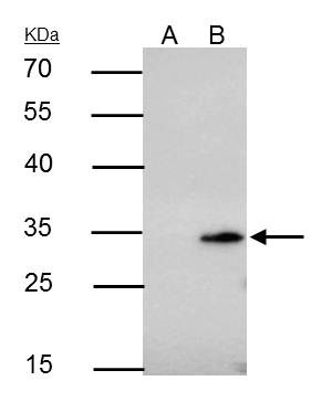 Bcl-10 Antibody in Immunoprecipitation (IP)