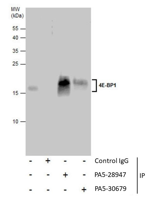 4EBP1 Antibody in Immunoprecipitation (IP)