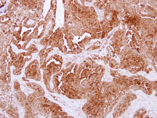 NPC2 Antibody in Immunohistochemistry (Paraffin) (IHC (P))