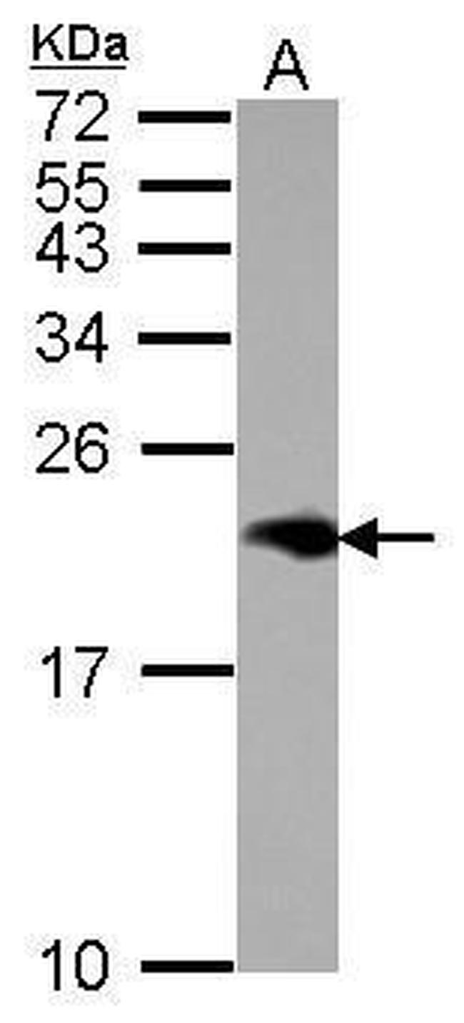 NPC2 Antibody in Western Blot (WB)