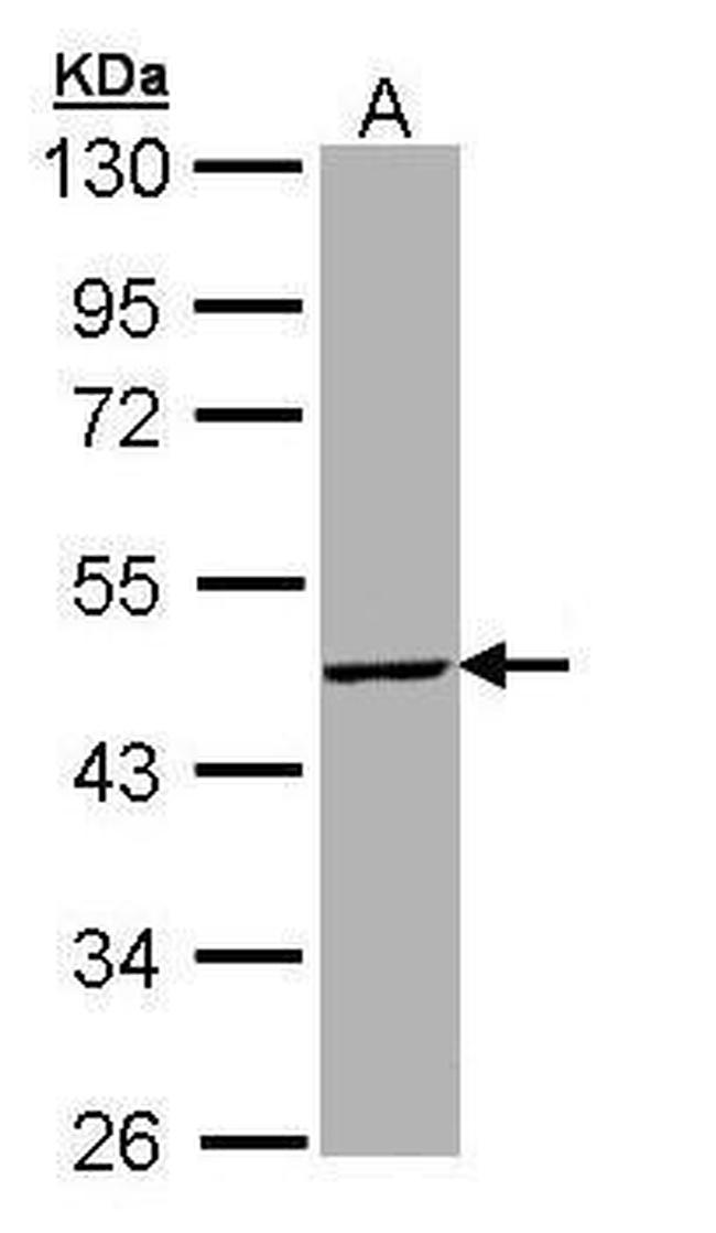 TBX19 Antibody in Western Blot (WB)