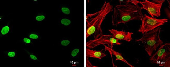 NSD3 Antibody in Immunocytochemistry (ICC/IF)