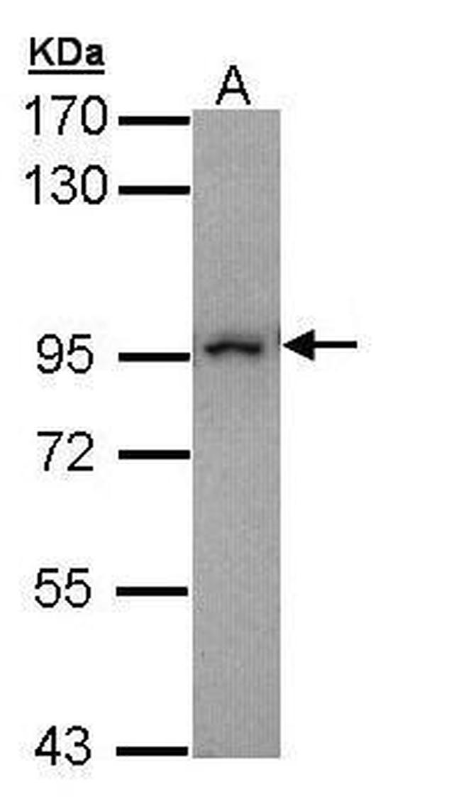 MAD1 Antibody in Western Blot (WB)