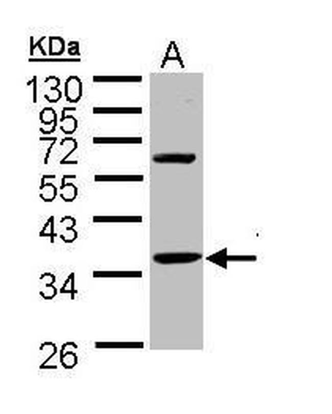 TNNT1 Antibody in Western Blot (WB)