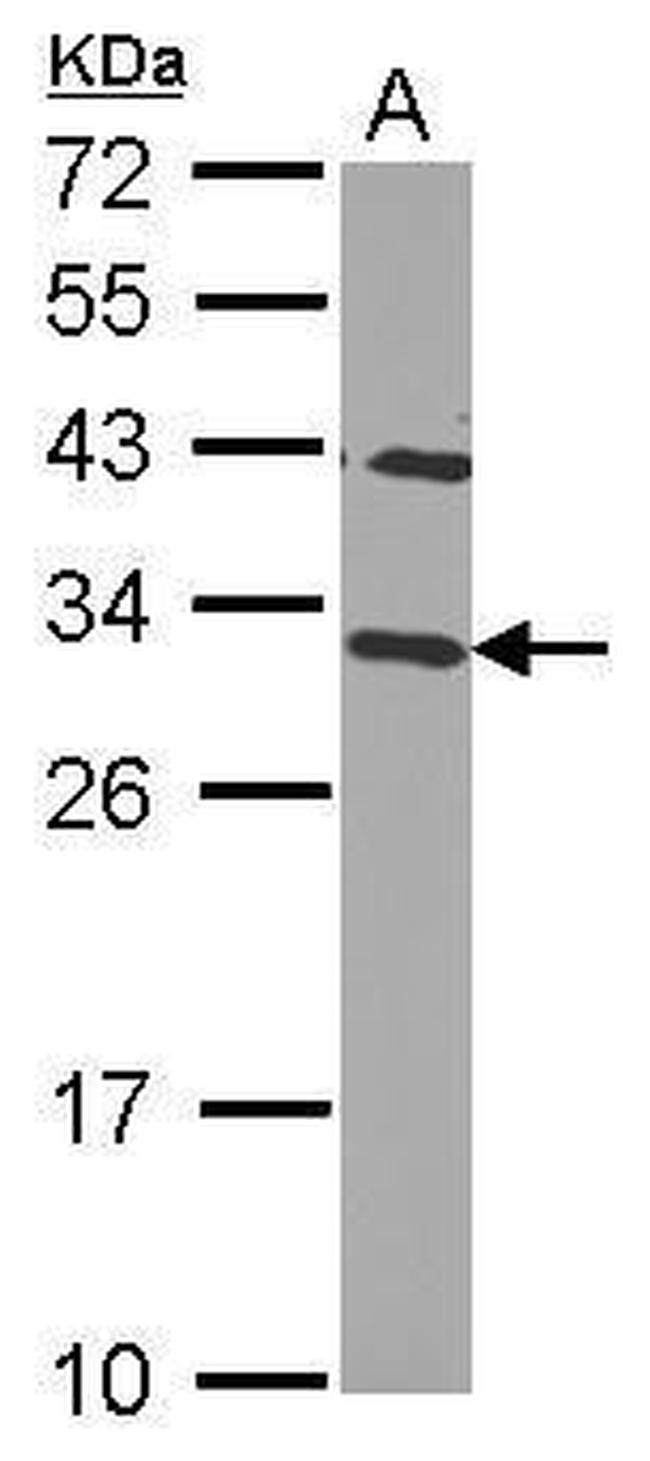 CHMP2B Antibody in Western Blot (WB)