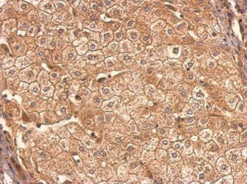 CCR6 Antibody in Immunohistochemistry (Paraffin) (IHC (P))