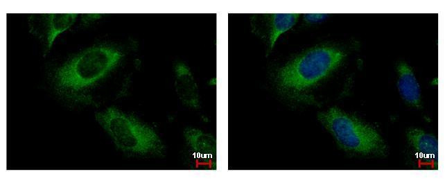 PPM1A Antibody in Immunocytochemistry (ICC/IF)