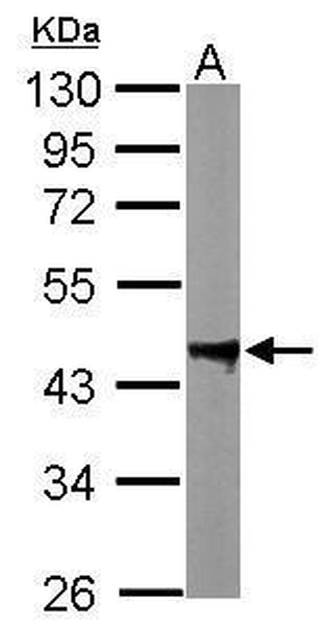 PPM1A Antibody in Western Blot (WB)