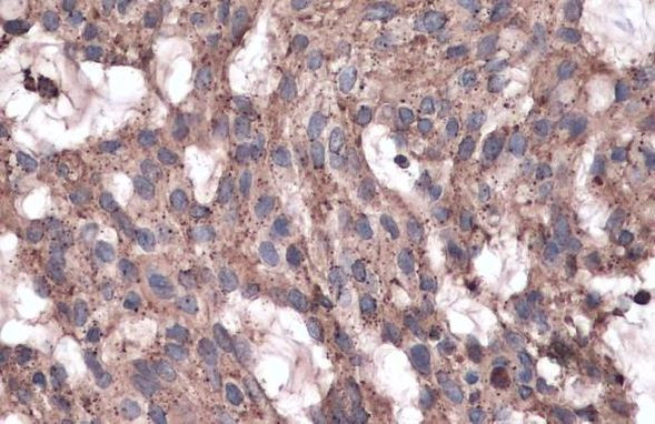 LYAG Antibody in Immunohistochemistry (Paraffin) (IHC (P))