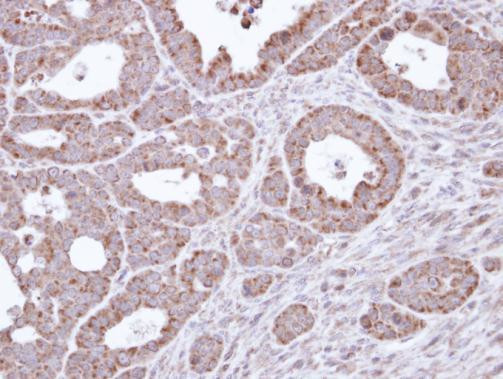 B3GALTL Antibody in Immunohistochemistry (Paraffin) (IHC (P))