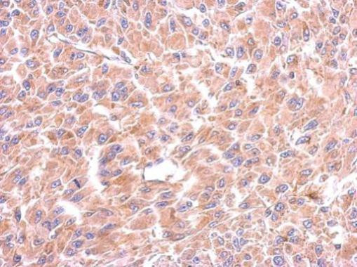 WARS Antibody in Immunohistochemistry (Paraffin) (IHC (P))