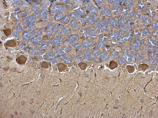 WARS Antibody in Immunohistochemistry (Paraffin) (IHC (P))