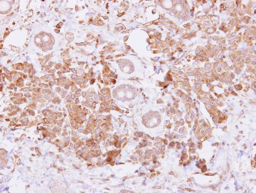 BMP-15 Antibody in Immunohistochemistry (Paraffin) (IHC (P))