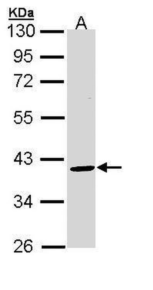 BMP-15 Antibody in Western Blot (WB)