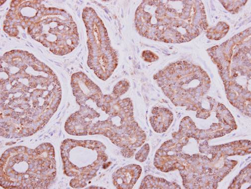 PYGM Antibody in Immunohistochemistry (Paraffin) (IHC (P))