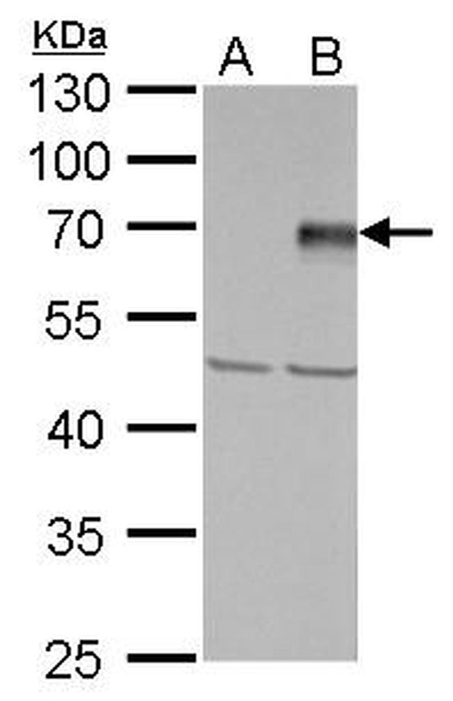 PIASy Antibody in Western Blot (WB)