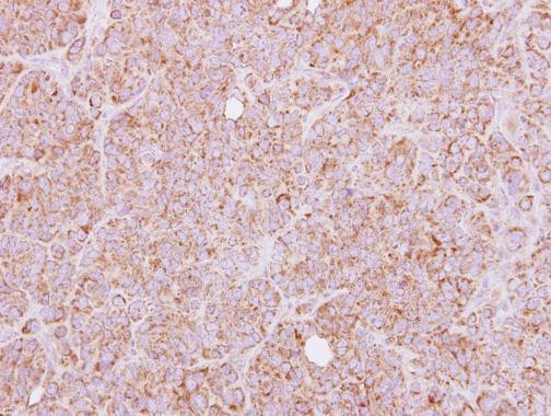 HTRA2 Antibody in Immunohistochemistry (Paraffin) (IHC (P))