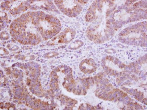 Gemin 3 Antibody in Immunohistochemistry (Paraffin) (IHC (P))