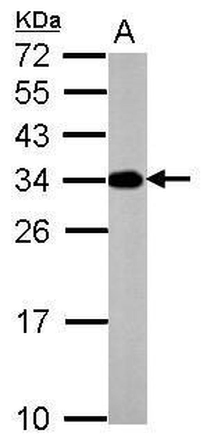V-ATPase E2 Antibody in Western Blot (WB)