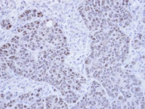 PPIL2 Antibody in Immunohistochemistry (Paraffin) (IHC (P))