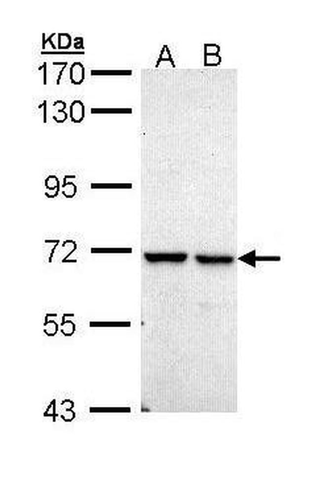 PPIL2 Antibody in Western Blot (WB)