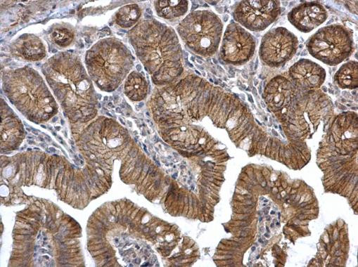 alpha Catenin Antibody in Immunohistochemistry (Paraffin) (IHC (P))