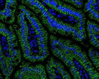 alpha Catenin Antibody in Immunohistochemistry (Paraffin) (IHC (P))