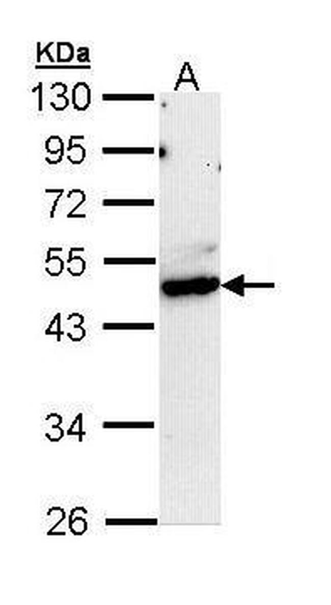 CtBP1 Antibody in Western Blot (WB)