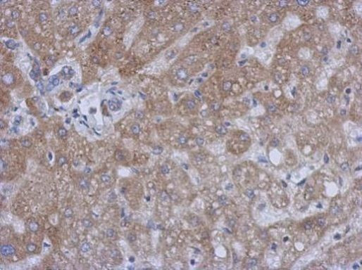 TIMP1 Antibody in Immunohistochemistry (Paraffin) (IHC (P))