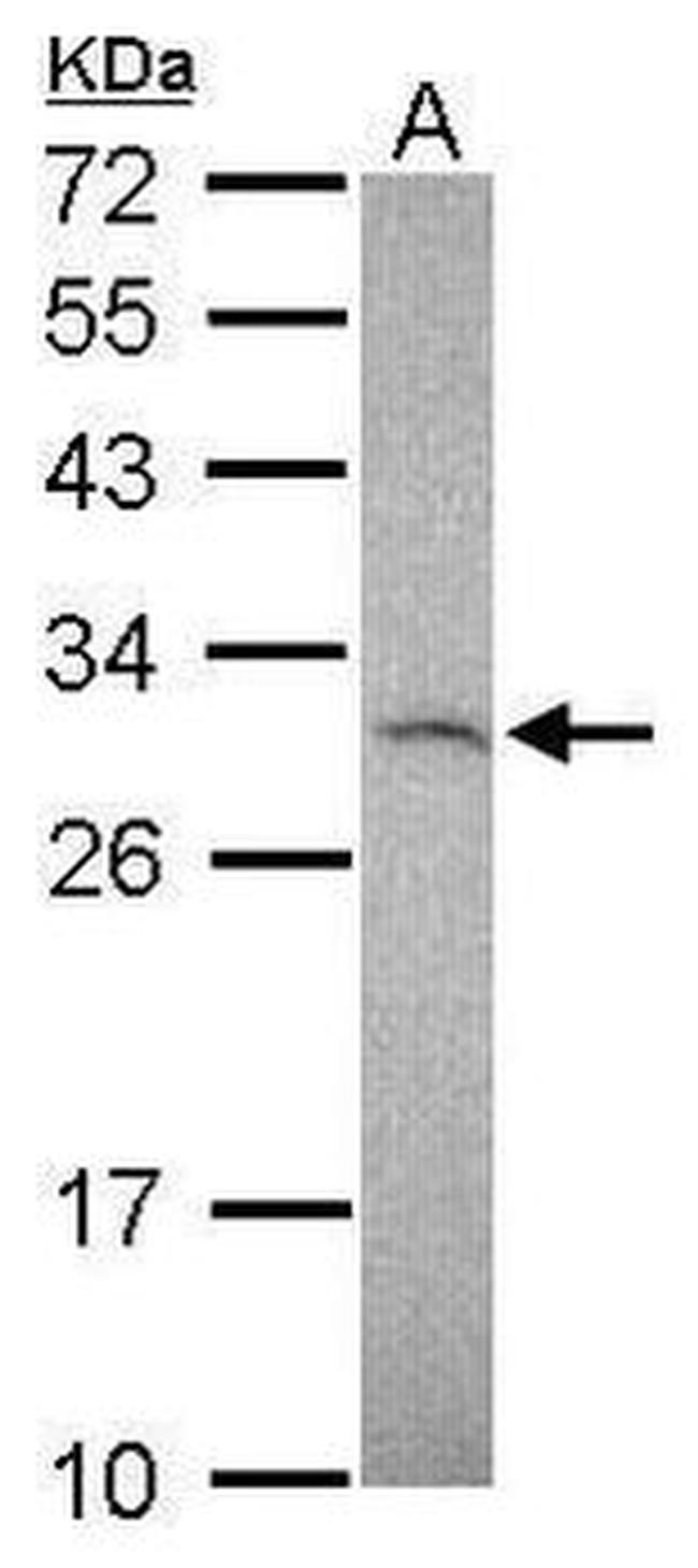 TIMP1 Antibody in Western Blot (WB)