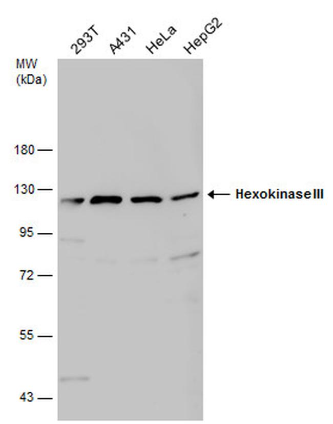 HK3 Antibody in Western Blot (WB)