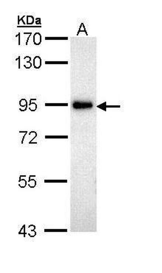 ZAK Antibody in Western Blot (WB)