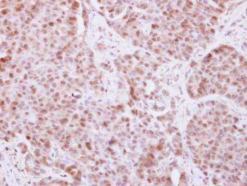 ELP4 Antibody in Immunohistochemistry (Paraffin) (IHC (P))