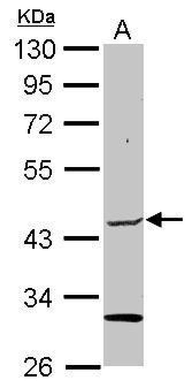 ELP4 Antibody in Western Blot (WB)