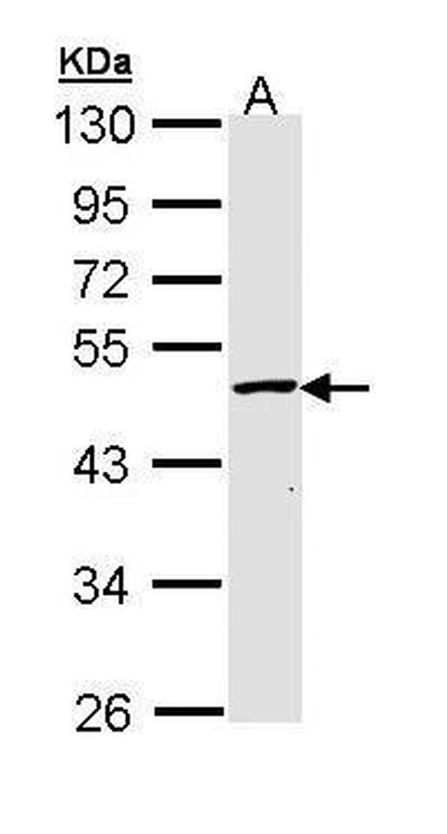 GALK2 Antibody in Western Blot (WB)