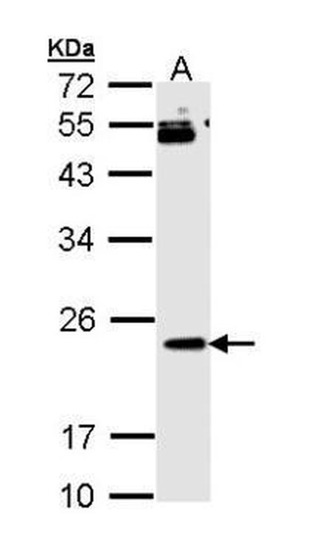 RAP1B Antibody in Western Blot (WB)