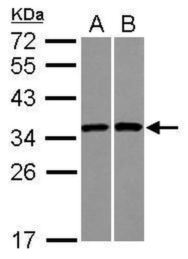 RPS3A Antibody in Western Blot (WB)