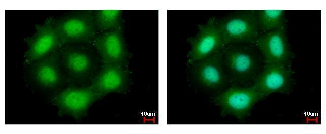 Securin Antibody in Immunocytochemistry (ICC/IF)