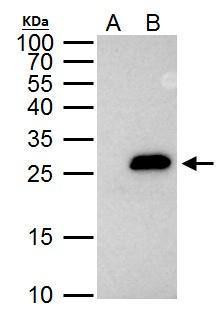 Securin Antibody in Immunoprecipitation (IP)