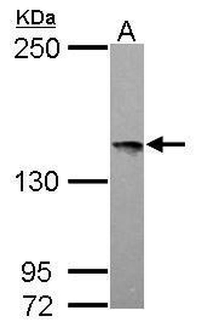 LOK Antibody in Western Blot (WB)