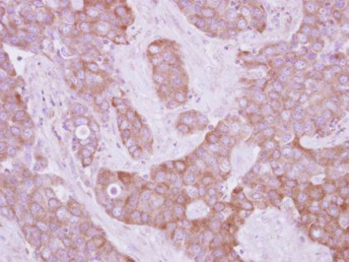 LOK Antibody in Immunohistochemistry (Paraffin) (IHC (P))