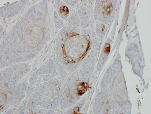 TRIB1 Antibody in Immunohistochemistry (Paraffin) (IHC (P))