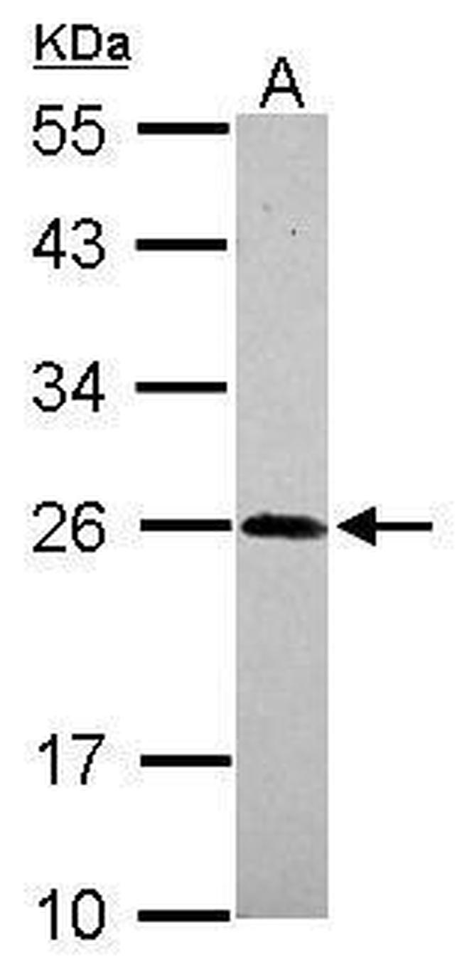 NGF Antibody in Western Blot (WB)